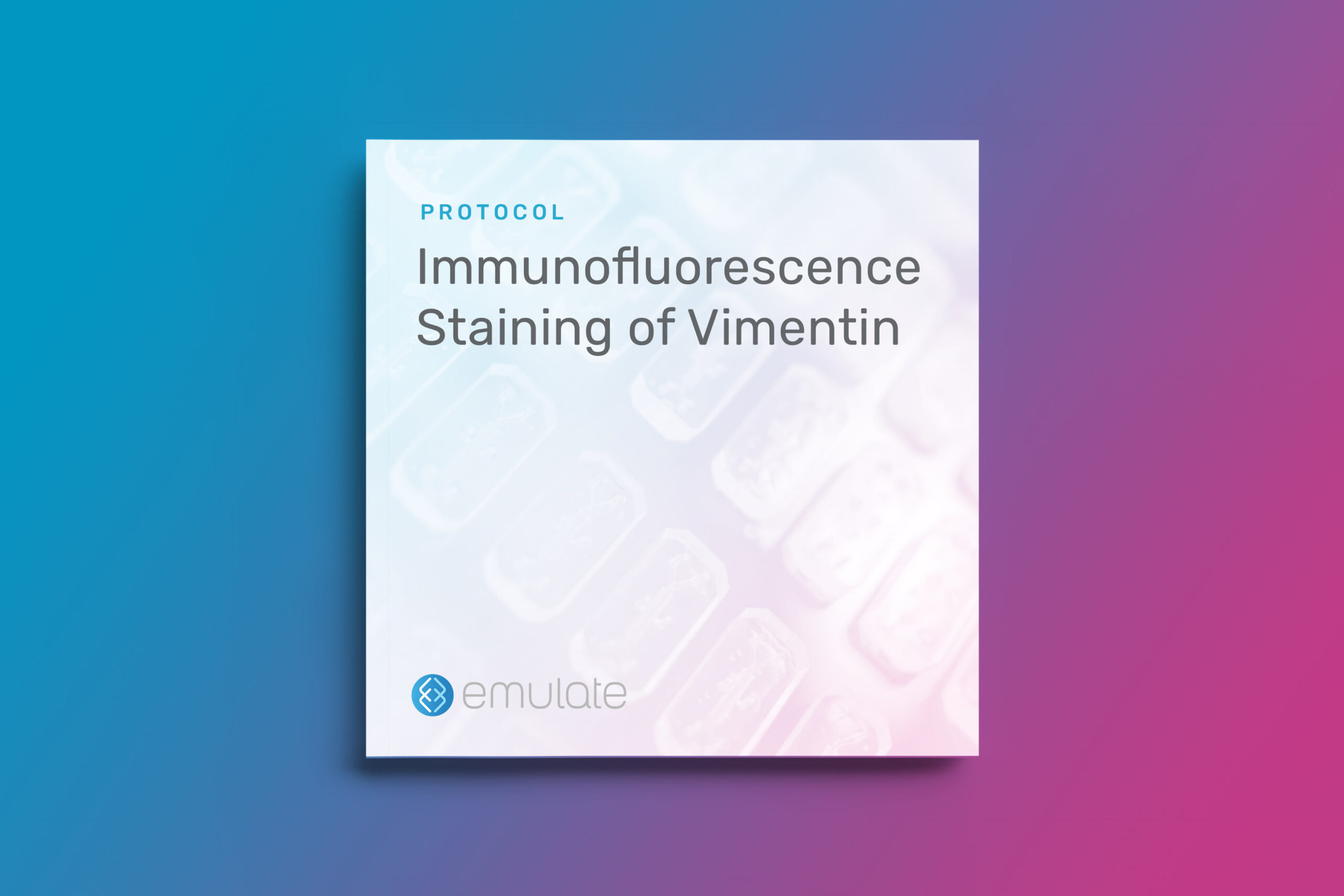 Immunofluorescence Staining of Vimentin