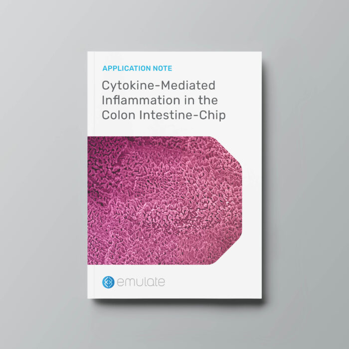 Image for Cytokine-Mediated Inflammation in the Colon Intestine-Chip