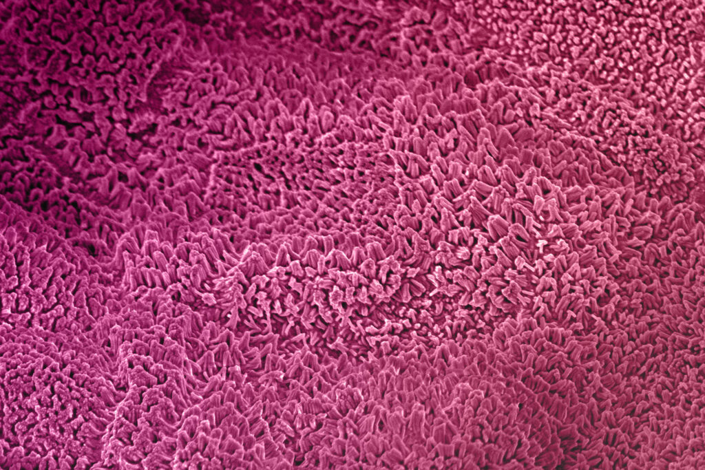 Scanning electron microsopy image of human colon microvilli in the Colon Intestine-Chip, recolored in pink.