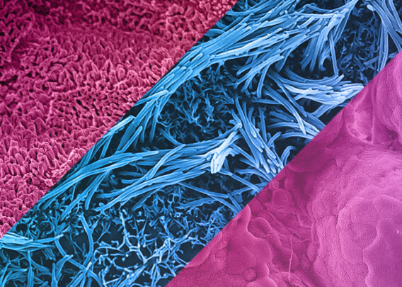 Image for Using Organs-On-Chips to Evaluate On-Target/Off-Tumor Effects of Cancer Immunotherapies