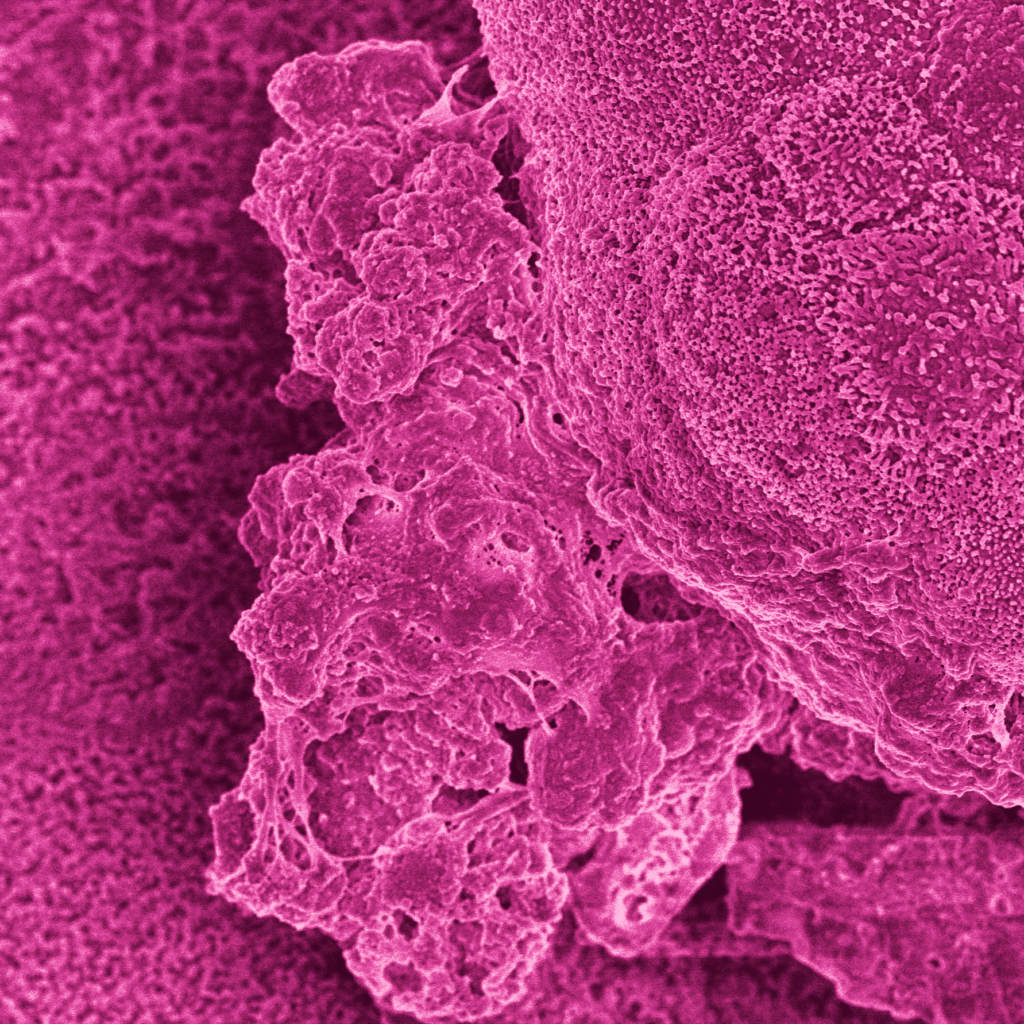 Colon Intestine-Chip morphology captured with SEM and colorized