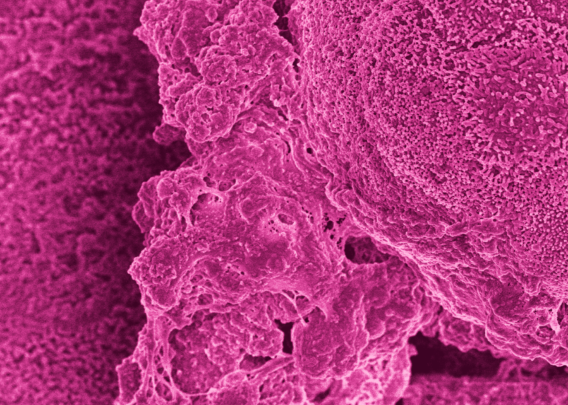 Image for Studying Gut Inflammation and Barrier Disruption with Organ-on-a-Chip Technology