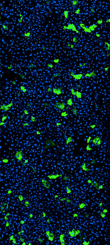 A tall, vertical image showing fluorescence microsopy image of adeno-associated virus transduction of hepatocytes in the Liver-Chip.