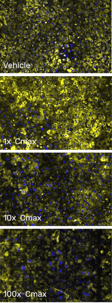 Microsopy images of human hepatocytes in the Liver-Chip after  exposure to a toxic compound. Images show a concentration-dependent decrease in mitochondria (yellow) in response to treatment with sitaxsentan.