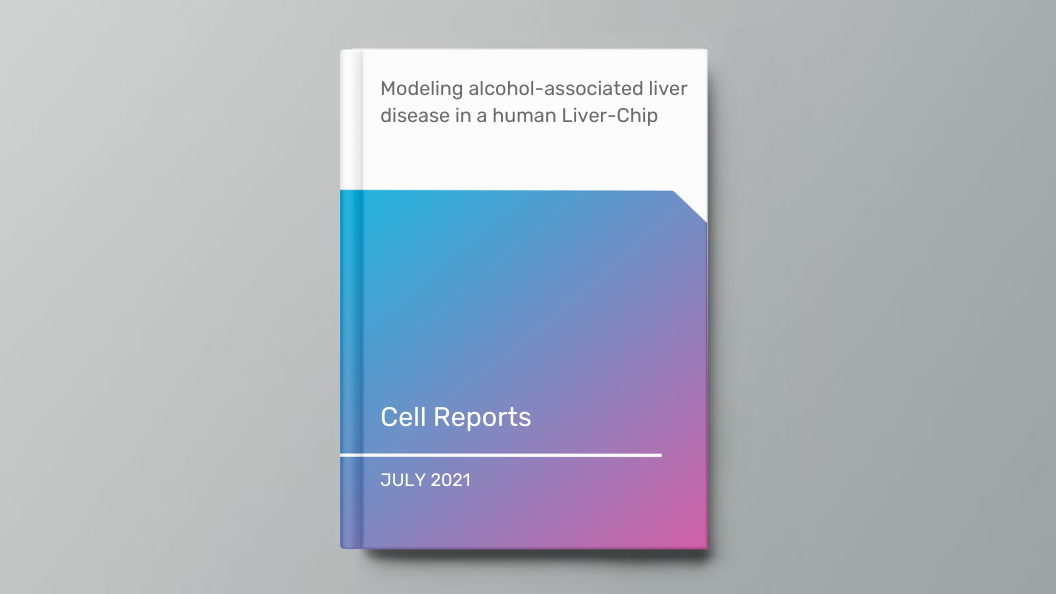 Modeling alcohol-associated liver disease in a human Liver-Chip