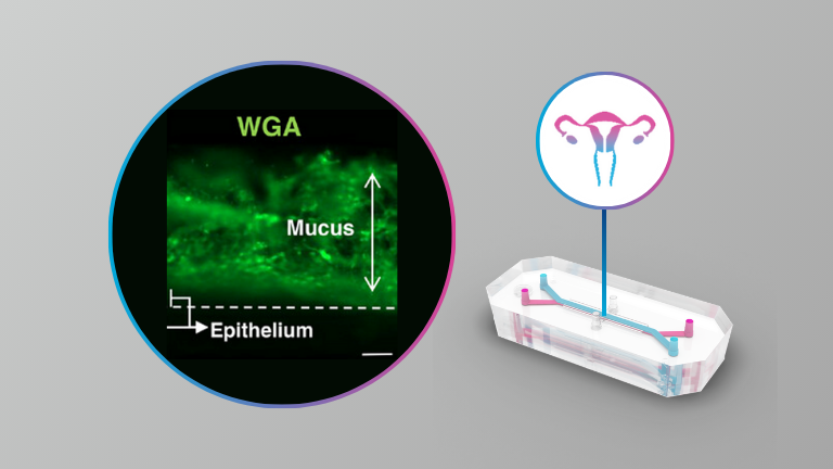 Human Cervix Chip: A Preclinical Model for Studying the Role of the Cervical Mucosa and Microbiome in Female Reproductive Health