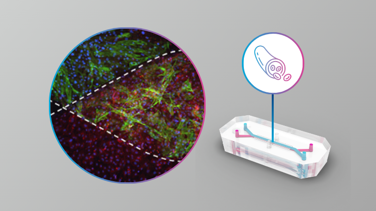 Human coronary artery tri-culture organ-chip recapitulates anti-inflammatory effect of pulsatile wall strain