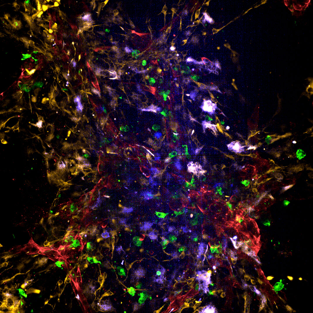 Emulate human Brain-Chip