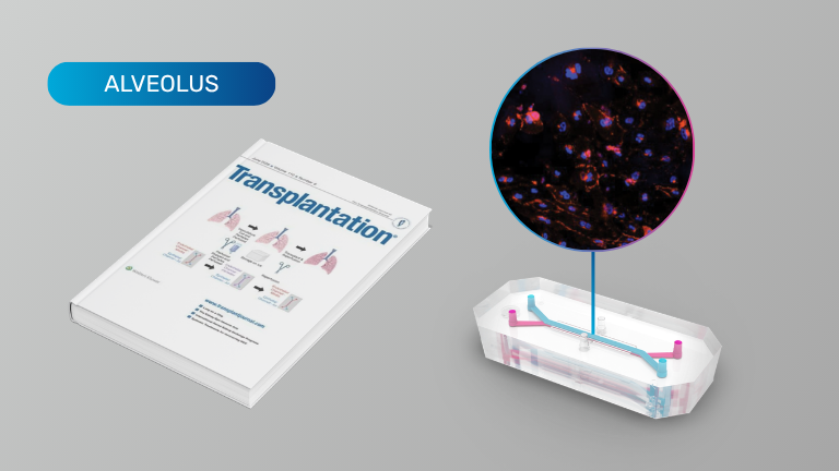 Alveolus-on-a-Chip: A Novel Tool for Modeling Lung Transplant Cold Storage Ischemia/Reperfusion Injury